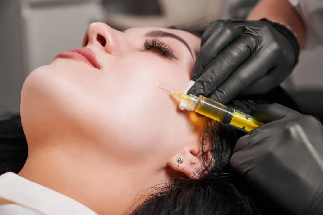 PRP Facial: What It Is, Benefits & What to Expect
