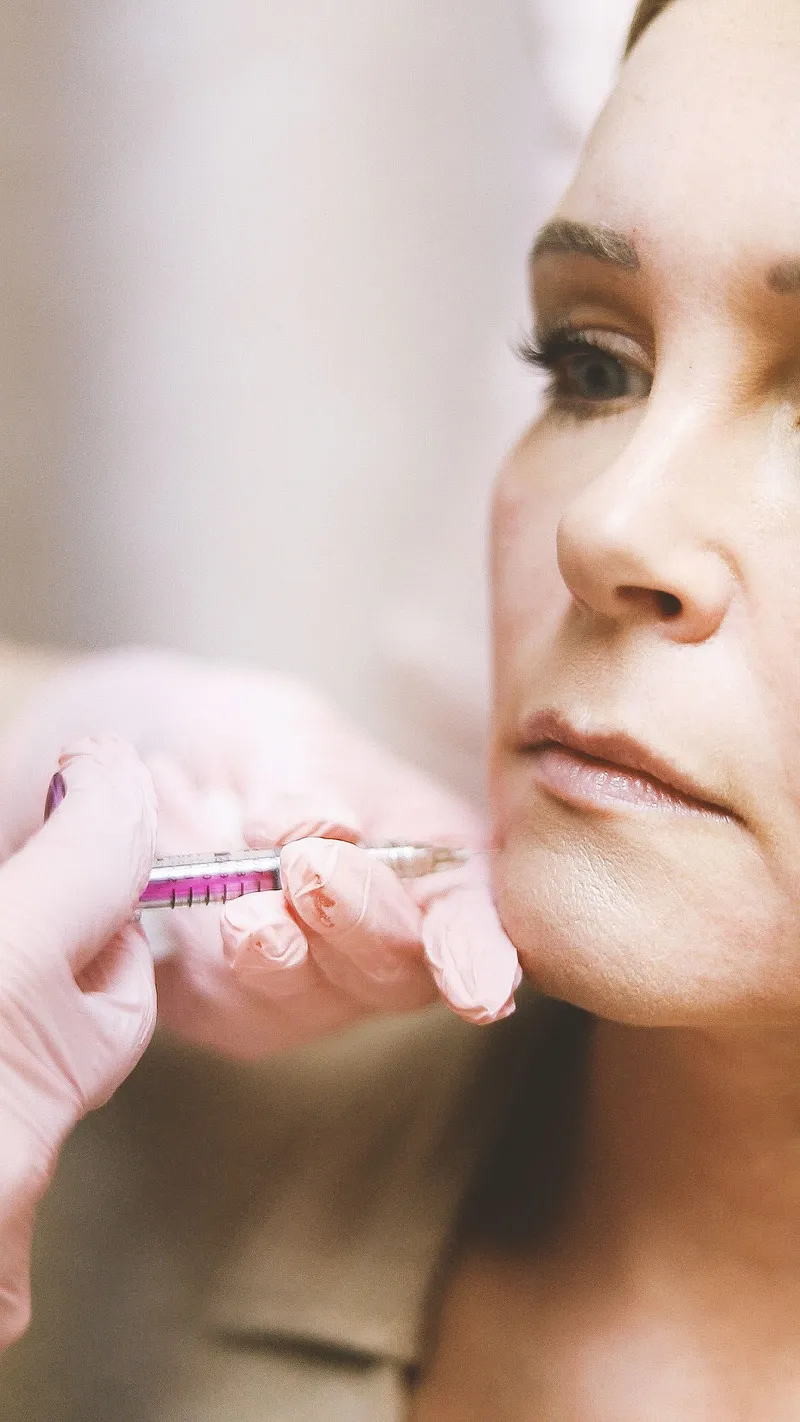 A dermal filler treatment being administered near the under-eye area